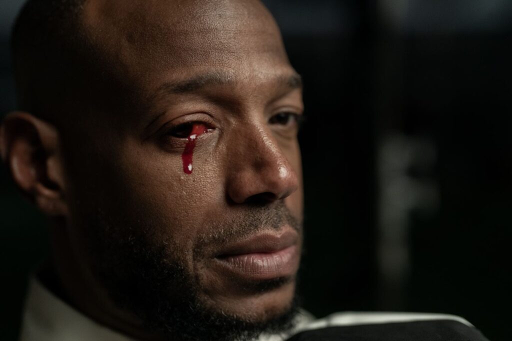Marlon Wayan with blood in one eye in a still photo